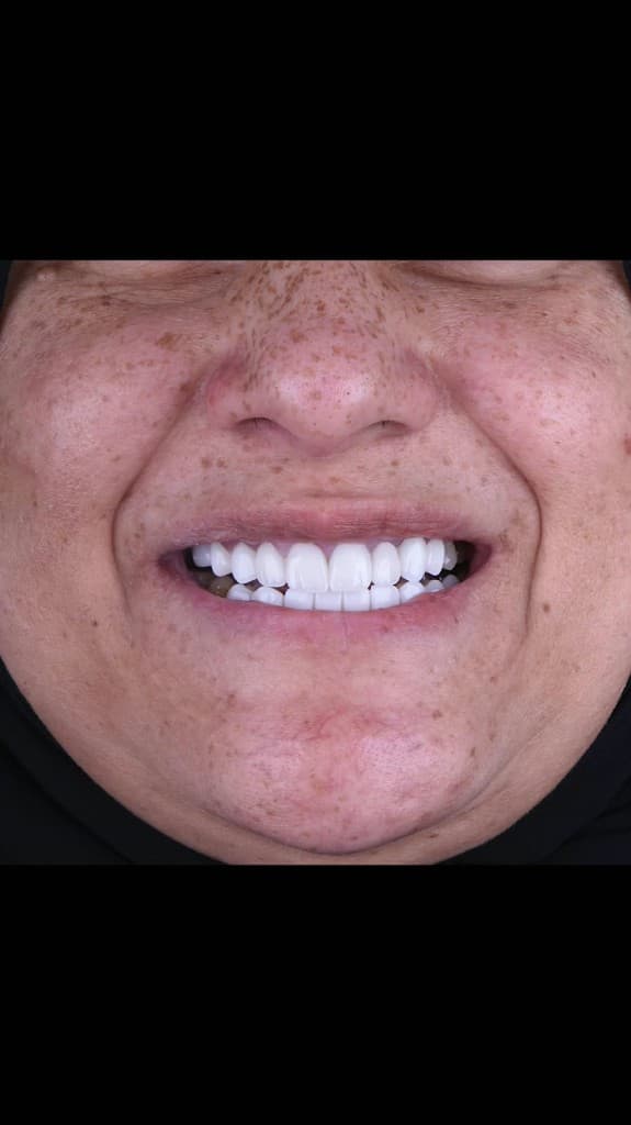 التيجان والكباري — قبل وبعد — بعد